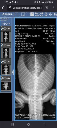 xray 1.jpg xray 1.jpg