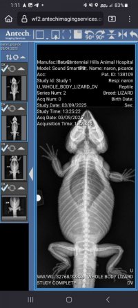 xray 2.jpg xray 2.jpg